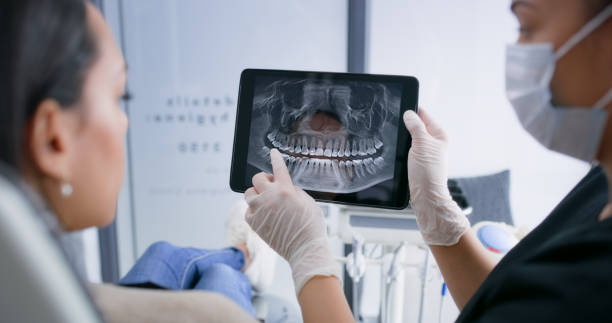 Licensed Tooth Extraction service in Westfield, NJ - Smile Center Dentistry